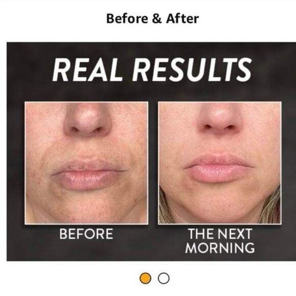 Microderm GLO Diamond Microdermabrasion Advanced Professional Skincare - Picture 12 of 13